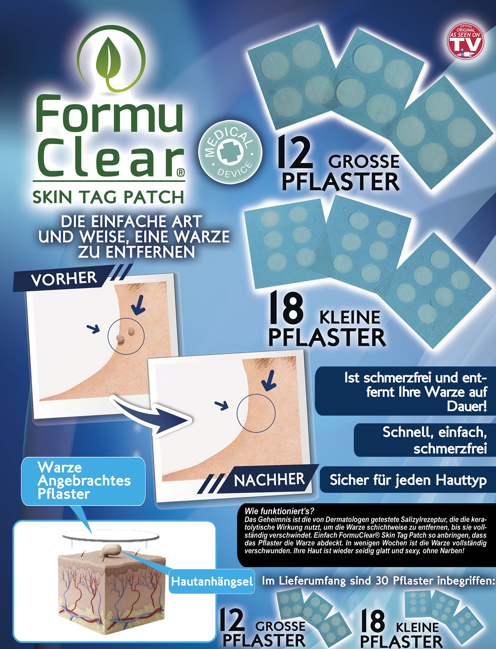Formu Clear Skin Tag Patch - assortiment van 30 stuks - wrattenpleisters